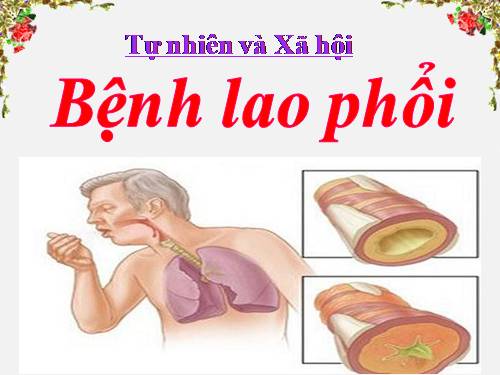 Bài 5. Bệnh lao phổi