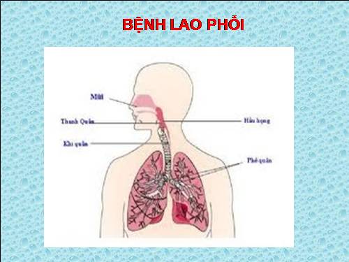 Bài 5. Bệnh lao phổi