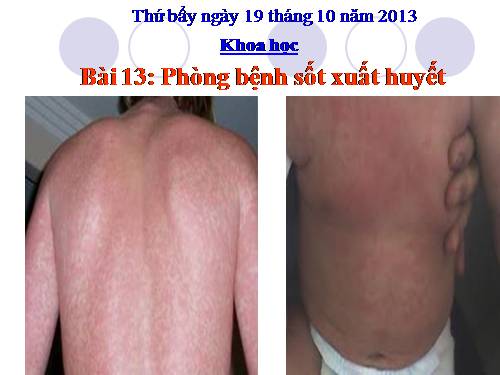 Bài 13. Phòng bệnh sốt xuất huyết