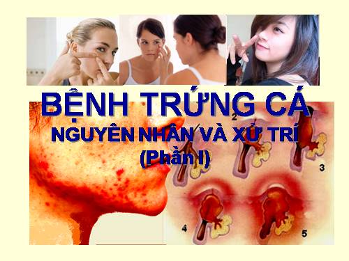 BỆNH TRỨNG CÁ (P1).ppt