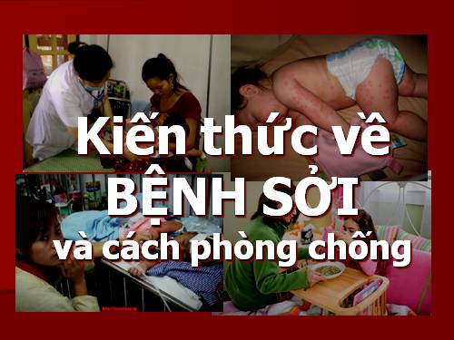 Kiến thứ về BỆNH SỞI Presentation