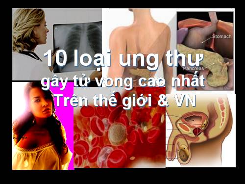 10 loại ung thư tử vong cao nhất thế giới