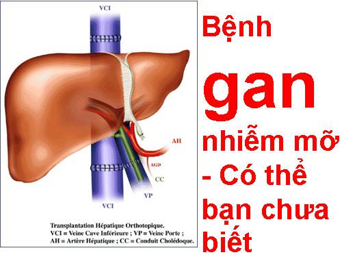 GAN NHIỄM MỠ!