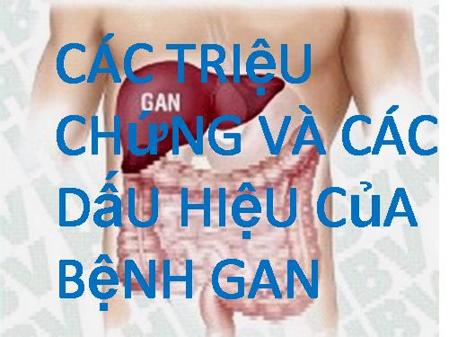 DẤU HIỆU CỦA BỆNH GAN.