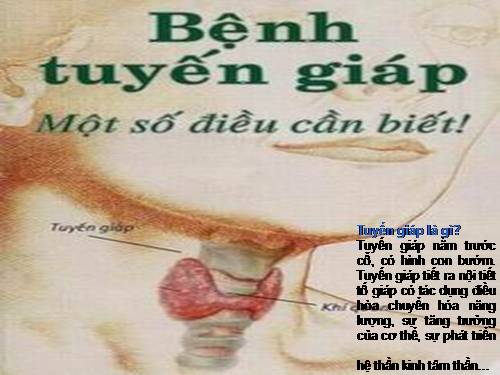 Bệnh suy cường giáp