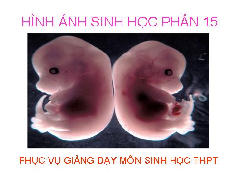 HÌNH ÂNH SINH HỌC PHAN 15