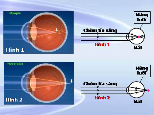 Bài 49. Mắt cận và mắt lão