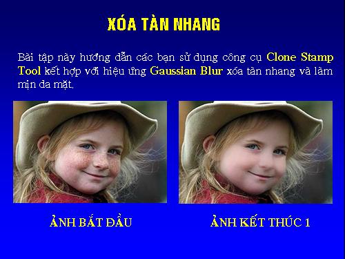 Thủ thuật Photoshop - xóa tàn nhang