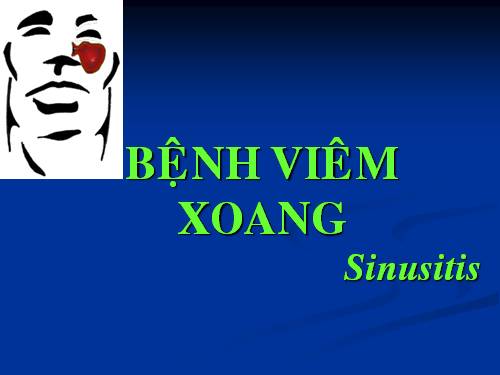 Viêm xoang