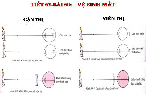 Bài 50 Vệ sinh mắt