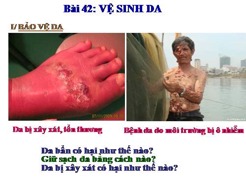 Bài 42. Vệ sinh da