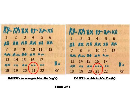 Bài 30. Di truyền học với con người