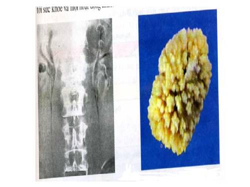 Bộ tranh Môn Sinh học THCS