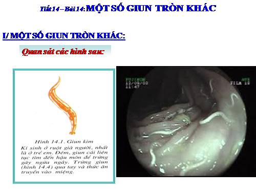 Bài 14. Một số giun tròn khác và đặc điểm chung của ngành Giun tròn