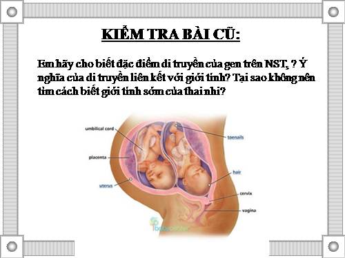 Bài 13. Ảnh hưởng của môi trường lên sự biểu hiện của gen