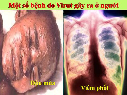 Bài 31. Virut gây bệnh, ứng dụng của virut trong thực tiễn